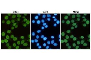 Immunofluorescent analysis of Hela cells fixed with 4 % Paraformaldehyde and using anti-BRG1 mouse mAb (dilution 1:50). (SMARCA4 Antikörper)