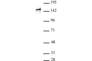 STAG1 antibody (pAb) tested by Western blot. (Stromal Antigen 1 Antikörper  (C-Term))