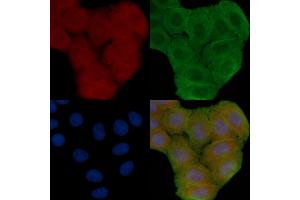ABIN6258807 and ABIN6273863 staining Hela cells(30 min of UV treatment) by IF/ICC. (GPR25 Antikörper  (Internal Region))