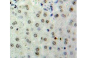 Immunohistochemistry (IHC) image for anti-Histone H2B Type 2-E (HIST2H2BE) (AA 2-126) antibody (ABIN1980427)
