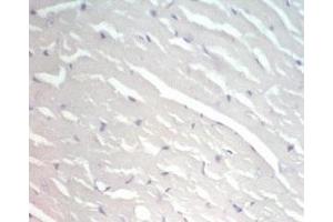 Immunohistochemistry (IHC) image for anti-Adiponectin Receptor 2 (ADIPOR2) (AA 374-386) antibody (ABIN2871645)