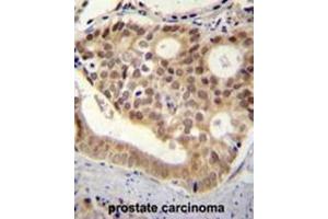 C11orf53 antibody (C-term) immunohistochemistry analysis in formalin fixed and paraffin embedded human pancreas tissue followed by peroxidase conjugation of the secondary antibody and DAB staining. (C11orf53 Antikörper  (C-Term))