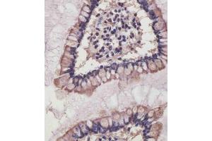 (ABIN6242485 and ABIN6578840) staining NRAS in human small intestine tissue sections by Immunohistochemistry (IHC-P - paraformaldehyde-fixed, paraffin-embedded sections). (GTPase NRas Antikörper)