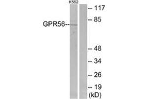 Western Blotting (WB) image for anti-G Protein-Coupled Receptor 56 (GPR56) (AA 251-300) antibody (ABIN2890875) (GPR56 Antikörper  (AA 251-300))
