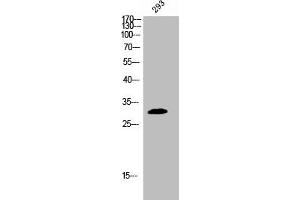Western Blot analysis of 293 cells using Phospho-BAM32 (Y139) Polyclonal Antibody (DAPP1 Antikörper  (pTyr139))