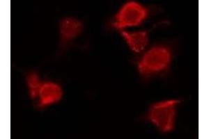 ABIN6277893 staining Hela by IF/ICC. (ERN1 Antikörper  (Internal Region))