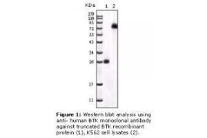 Image no. 2 for anti-Bruton Agammaglobulinemia tyrosine Kinase (BTK) antibody (ABIN232137) (BTK Antikörper)