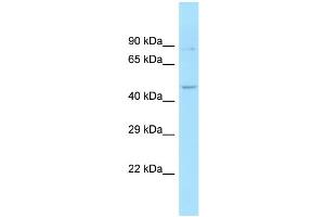 WB Suggested Anti-SNX6 Antibody Titration: 1. (SNX6 Antikörper  (Middle Region))