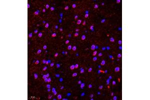 Immunohistochemistry of paraffin embedded mouse brain using CDH19 (ABIN7073258) at dilution of 1:500 (400x lens) (CDH19 Antikörper)