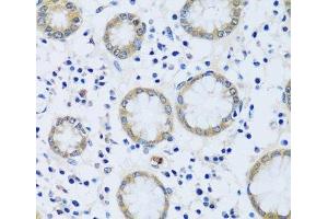 Immunohistochemistry of paraffin-embedded Human stomach using CABP7 Polyclonal Antibody at dilution of 1:100 (40x lens). (CABP7 Antikörper)