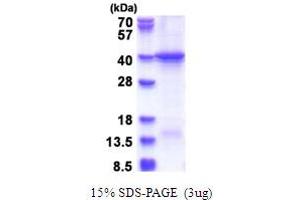 SDS-PAGE (SDS) image for Hect Domain and RLD 5 (HERC5) (AA 681-1024) protein (His tag) (ABIN5853692)