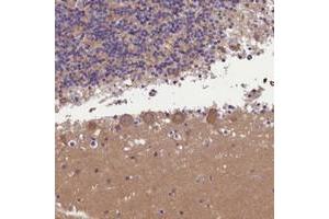 Immunohistochemical staining of human cerebellum with AP3B2 polyclonal antibody  shows moderate cytoplasmic positivity in Purkinje cells at 1:200-1:500 dilution. (AP3B2 Antikörper)