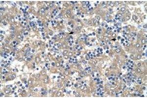 Immunohistochemical staining (Formalin-fixed paraffin-embedded sections) of human liver with C3orf10 polyclonal antibody  at 4-8 ug/mL working concentration. (BRK1 Antikörper  (Internal Region))