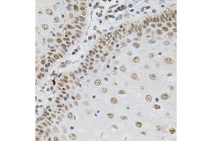 Immunohistochemistry of paraffin-embedded human esophagus using TGM2 antibody (ABIN5970369) (40x lens). (Transglutaminase 2 Antikörper)