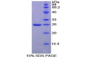 SDS-PAGE (SDS) image for Protein Interacting With Protein Kinase C, alpha 1 (PICK1) (AA 24-229) protein (His tag) (ABIN2126493) (PICK1 Protein (AA 24-229) (His tag))