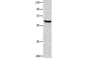 Western blot analysis of Human seminoma tissue, using DNAJC7 Polyclonal Antibody at dilution of 1:400 (DNAJC7 Antikörper)