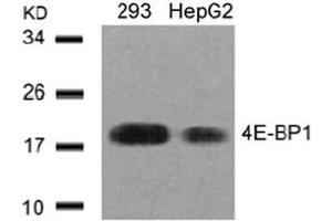Image no. 3 for anti-Eukaryotic Translation Initiation Factor 4E Binding Protein 1 (EIF4EBP1) (AA 43-47) antibody (ABIN197452) (eIF4EBP1 Antikörper  (AA 43-47))