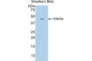 Detection of Recombinant C3a, Mouse using Polyclonal Antibody to Complement Component 3a (C3a) (C3a Antikörper  (AA 671-748))