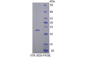 SDS-PAGE analysis of Mouse Interleukin 7 Receptor Protein. (IL7R Protein)