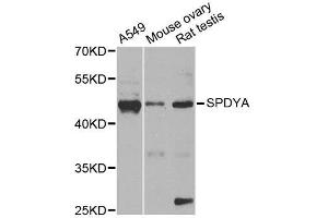 Western blot analysis of extracts of various cell lines, using SPDYA antibody. (SPDYA Antikörper  (AA 1-313))