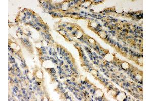 Anti- Rad51 Picoband antibody, IHC(P) IHC(P): Rat Intestine Tissue (RAD51 Antikörper  (AA 1-258))