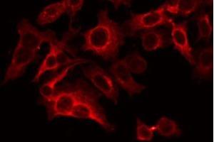 ABIN6266638 staining LOVO by IF/ICC. (Synaptophysin Antikörper  (Internal Region))