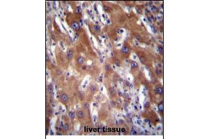 GNE Antibody (N-term) (ABIN656219 and ABIN2845536) immunohistochemistry analysis in formalin fixed and paraffin embedded human liver tissue followed by peroxidase conjugation of the secondary antibody and DAB staining. (GNE Antikörper  (N-Term))