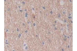 Immunohistochemistry (IHC) image for anti-C-Ros Oncogene 1 , Receptor tyrosine Kinase (ROS1) (AA 1945-2222) antibody (ABIN7442438)