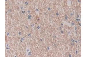 Detection of ROS1 in Human Cerebrum Tissue using Polyclonal Antibody to C-Ros Oncogene 1, Receptor Tyrosine Kinase (ROS1)