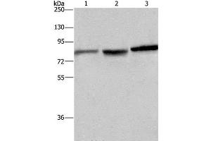 Western Blot analysis of Mouse brain tissue, A172 and Hela cell using DBH Polyclonal Antibody at dilution of 1:200 (DBH Antikörper)