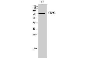 Western Blotting (WB) image for anti-CD93 (CD93) (Internal Region) antibody (ABIN3178943) (CD93 Antikörper  (Internal Region))