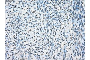 Immunohistochemical staining of paraffin-embedded Kidney tissue using anti-PPP5Cmouse monoclonal antibody. (PP5 Antikörper)
