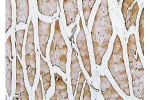 IHC analysis of Cofilin-2 using anti-Cofilin-2 antibody (ABIN7602747).