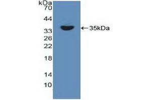 Western blot analysis of recombinant Human RELB. (RELB Antikörper  (AA 248-492))