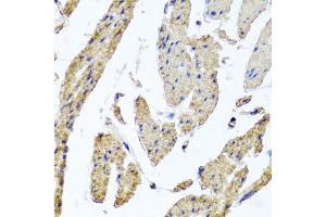 Immunohistochemistry of paraffin-embedded human esophageal smooth muscle using MRPL12 antibody at dilution of 1:100 (x40 lens).