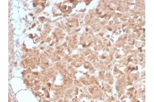 Formalin-fixed, paraffin-embedded human Pancreas stained with CELA3B Rabbit Recombinant Monoclonal Antibody (CELA3B/2809R). (Rekombinanter Elastase 3B Antikörper  (AA 82-238))