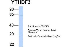 Host: Rabbit  Target Name: YTHDF3  Sample Tissue: Human Adult Placenta  Antibody Dilution: 1. (YTHDF3 Antikörper  (N-Term))