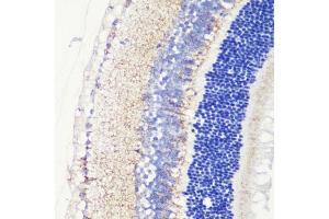 Immunohistochemistry of paraffin-embedded mouse retina using CRB1 antibody (ABIN7266524) at dilution of 1:200 (40x lens). (CRB1 Antikörper  (AA 20-200))