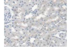 Figure. (CES1 Antikörper  (AA 19-300))