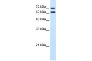 Image no. 2 for anti-Family with Sequence Similarity 55, Member D (FAM55D) (AA 407-456) antibody (ABIN205071) (FAM55D Antikörper  (AA 407-456))