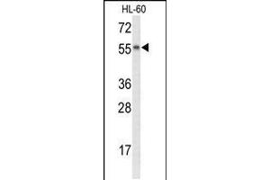 Western blot analysis of NYX Antibody in HL-60 cell line lysates (35ug/lane) (Nyctalopin Antikörper  (N-Term))