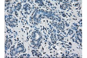 Immunohistochemical staining of paraffin-embedded breast tissue using anti-PPP5C mouse monoclonal antibody. (PP5 Antikörper)