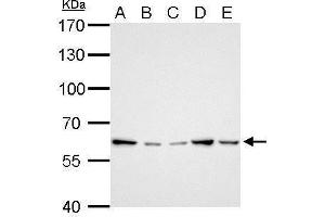 WB Image GGT1 antibody detects GGT1 protein by Western blot analysis. (GGT1 Antikörper)