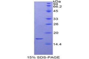 SDS-PAGE (SDS) image for Glycoprotein Ib (Platelet), beta Polypeptide (GP1BB) (AA 52-164) protein (His tag) (ABIN2125053) (GP1BB Protein (AA 52-164) (His tag))