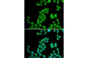 Immunofluorescence analysis of MCF-7 cell using RNASE13 antibody. (RNASE13 Antikörper  (AA 1-156))
