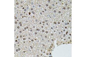 Immunohistochemistry (Paraffin-embedded Sections) (IHC (p)) image for anti-Polynucleotide Kinase 3'-Phosphatase (PNKP) (AA 60-320) antibody (ABIN6145836)