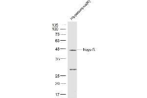 Rat Hippocampus lysates probed with Nogo Receptor Polyclonal Antibody, Unconjugated  at 1:500 dilution and 4˚C overnight incubation. (RTN4R Antikörper  (AA 151-350))