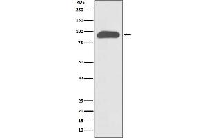 Western blot analysis of Chromogranin A expression in SH-SY5Y cell lysate.