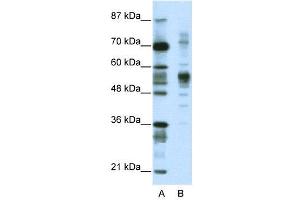 WB Suggested Anti-CORO1A  Antibody Titration: 1. (Coronin 1a Antikörper  (C-Term))