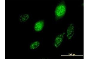 Immunofluorescence of purified MaxPab antibody to SCML1 on HeLa cell. (SCML1 Antikörper  (AA 1-208))